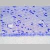 Neuronas Nissl 25.jpg